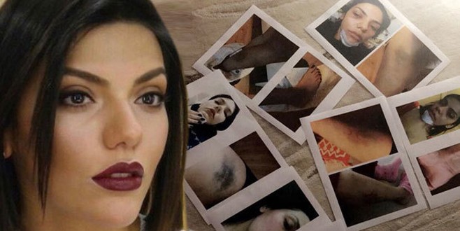 Eda Pera Küçük Haluk Levent'ten yardım istedi
