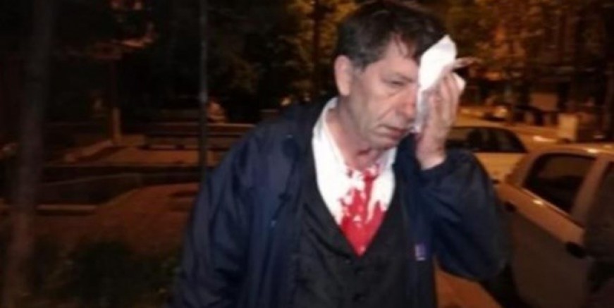 Yavuz Selim Demirağ saldırıya uğradı