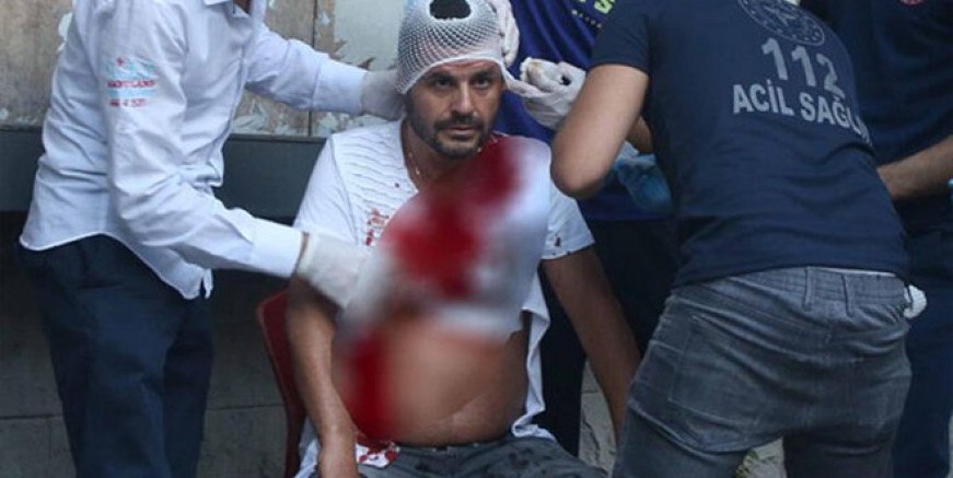 Volkan Hacısüleymanoğlu'na değnekçi dehşeti