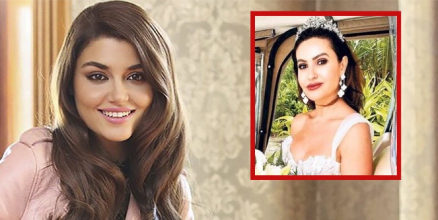 Hande Erçel dişleri hayatını kararttı