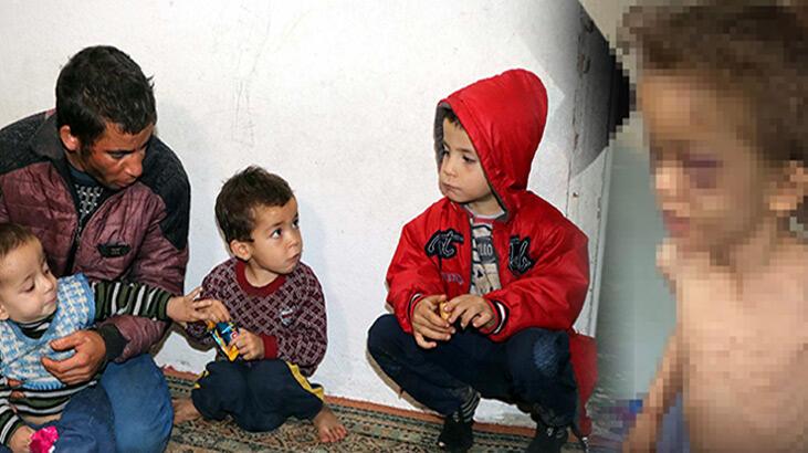 Gaziantep'te 5 yaşındaki çocuğa işkence!