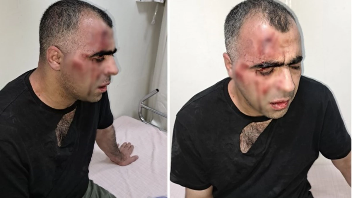 Gazeteci Sinan Aygül'ün darp edilmesiyle ilgili soruşturma