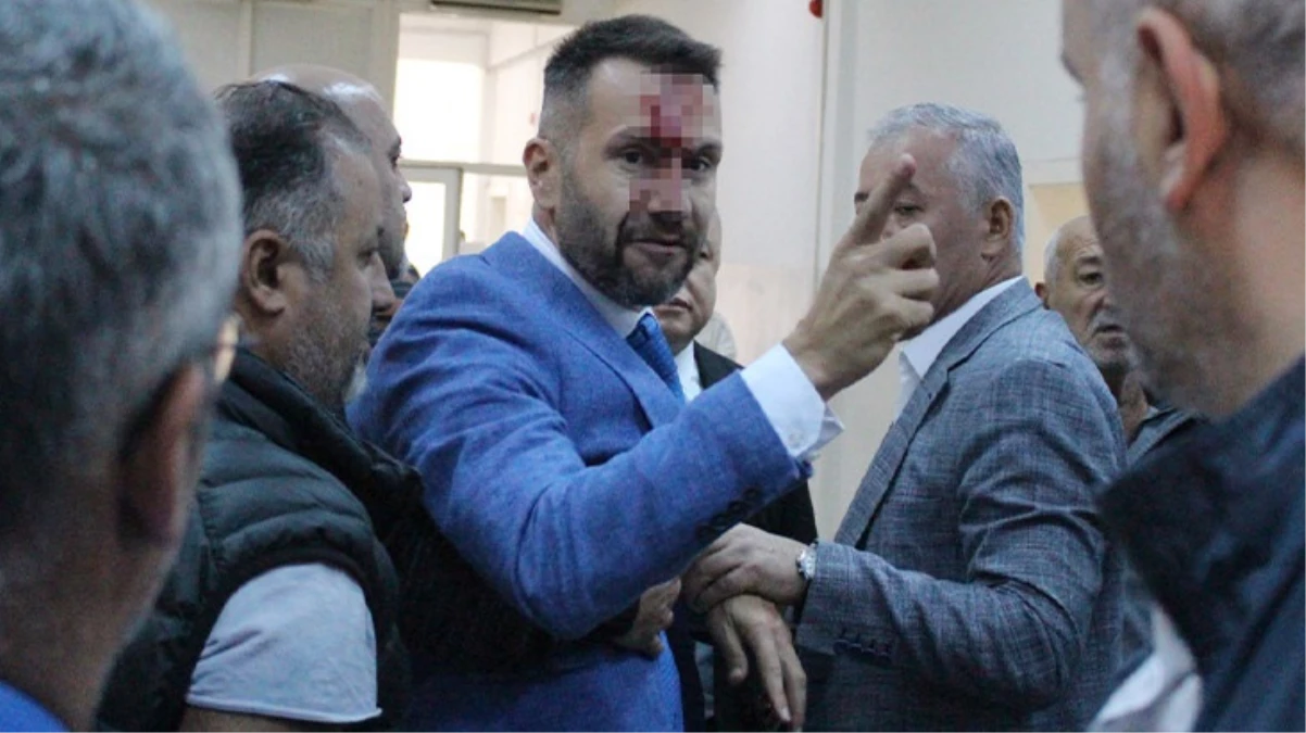 MHP'li meclis üyesi CHP'li üyenin burnunu kırdı