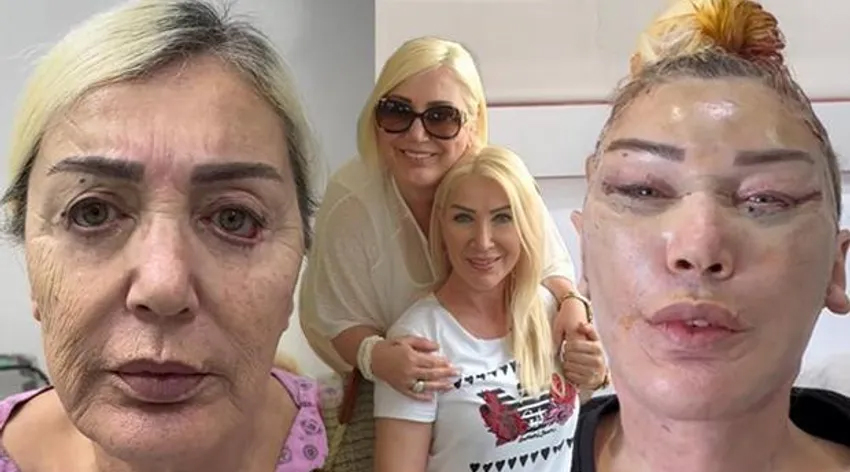 Seda Sayan'ın ablası estetik operasyonu geçirdi