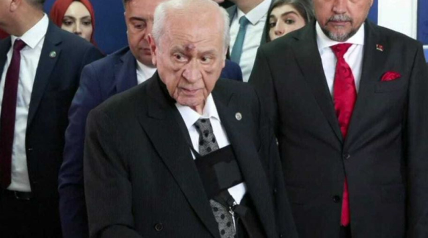 Bahçeli'nin yüzündeki morlukların nedeni belli oldu