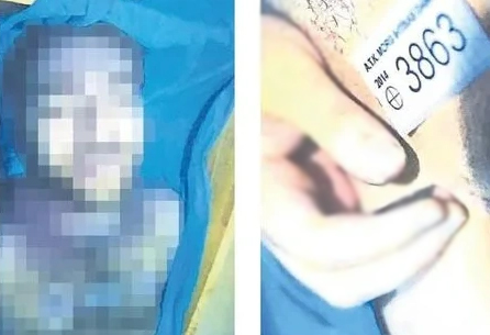 İşte Cem Garipoğlu'nun otopsi raporu