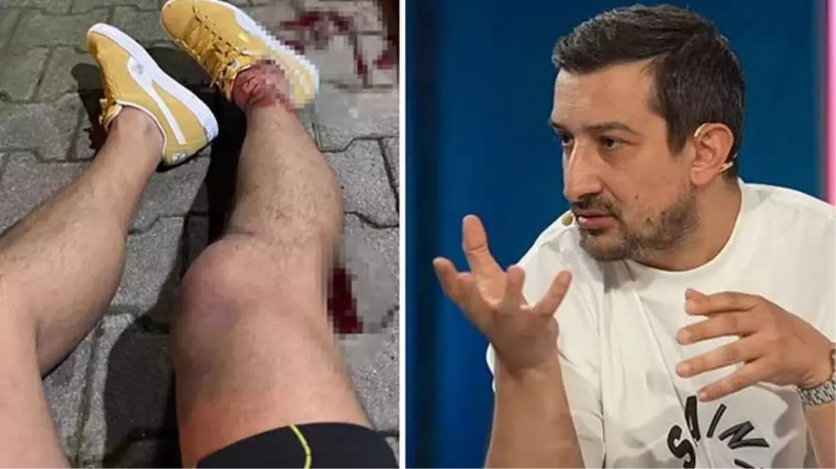 Serhat Akın'a saldırıdaki tüm şüpheliler yakalandı